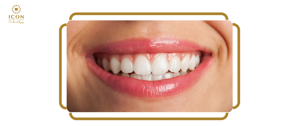 ابتسامة هوليود -عيادة ايكون