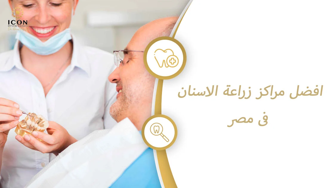 افضل مراكز زراعة الاسنان فى مصر