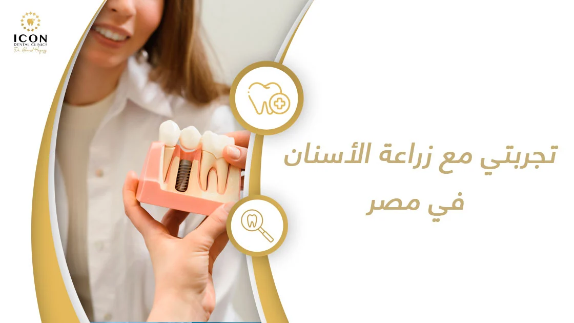 تجربتي مع زراعة الأسنان