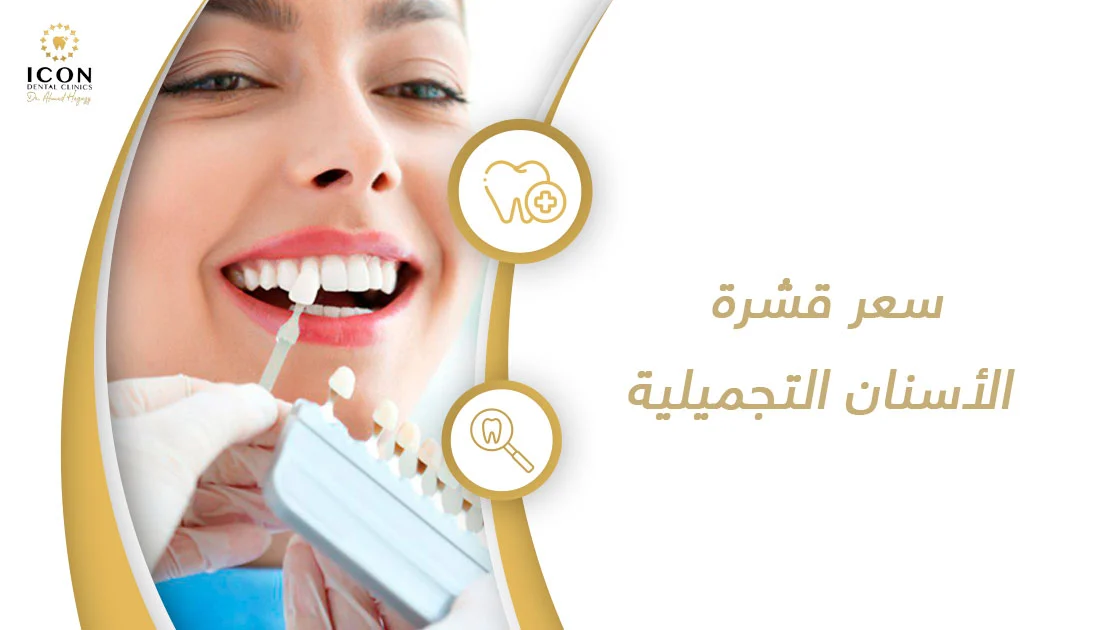 سعر قشرة الأسنان التجميلية